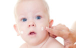 Признаки и лечение аллергии на лице и теле у младенца
